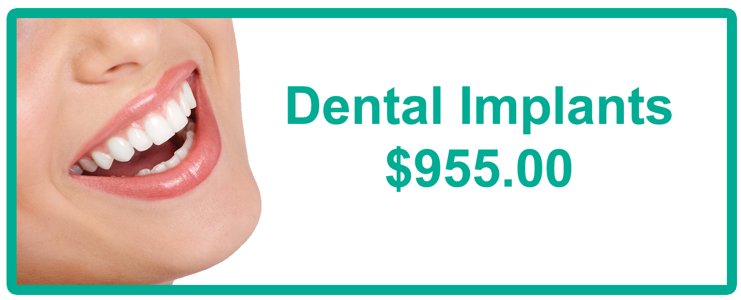 Dental Implants | Dentist in El Paso, TX | El Paso Viva Dental